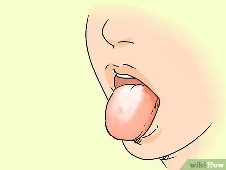 Image titled Get Rid of White Tongue Step 12