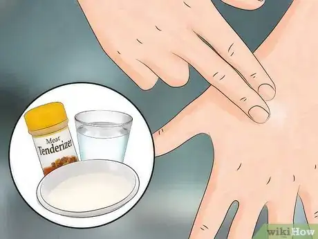 Image titled Reduce the Pain of Gnat Bites Step 6