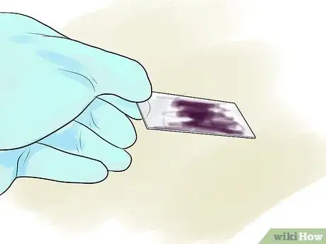 Image titled Gram Stain Step 11