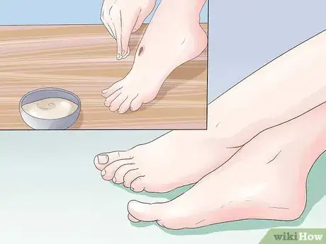 Image titled Get Rid of a Scab Step 16