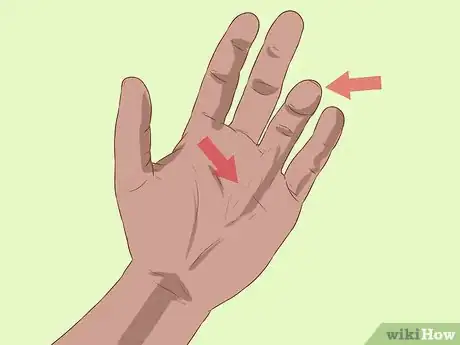 Image titled Diagnose Dupuytren's Contracture Step 2