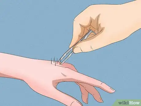 Image titled Remove Cactus Needles Step 1