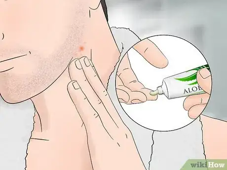 Image titled Stop Itching After Shaving Step 3