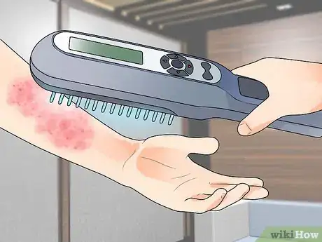 Image titled Get Rid of Eczema and Staph Step 7