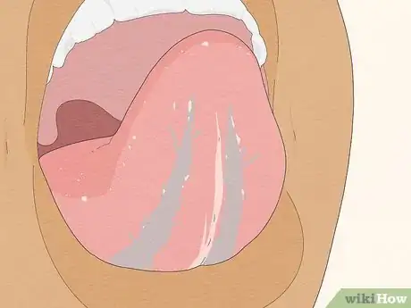 Image titled Pierce Your Own Tongue Step 6