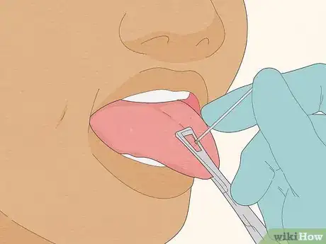 Image titled Pierce Your Own Tongue Step 8