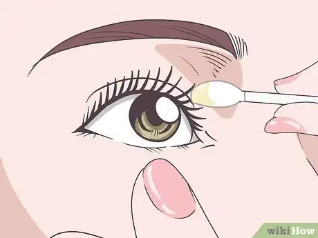 Image titled Treat Dry Eyelids Step 4