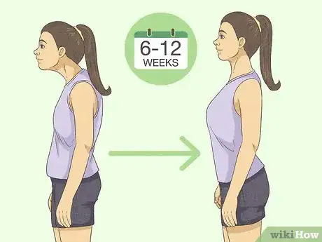 Image titled Select and Use a Posture Corrector Step 5