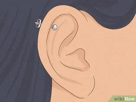 Image titled Heal Cartilage Piercing Bumps Step 1