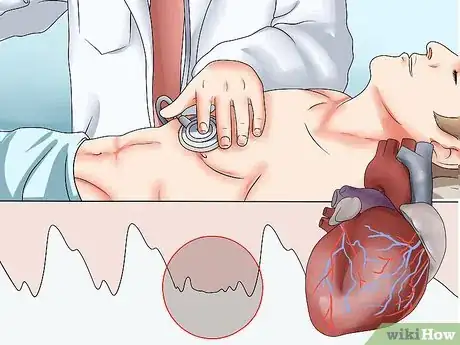 Image titled Take an Apical Pulse Step 13