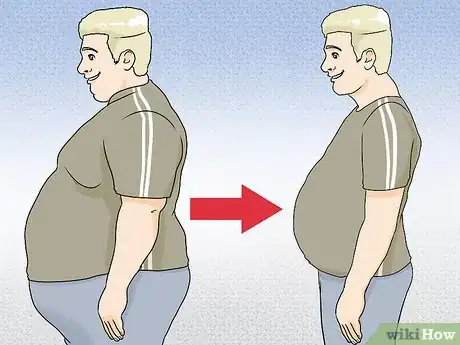 Image titled Overcome Obesity Step 20