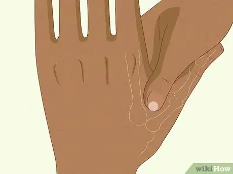 Image titled Stop Nausea With Acupressure Step 10