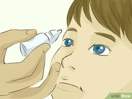 Image titled Use Eye Drops Step 26