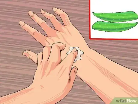 Image titled Grow and Use Aloe Vera for Medicinal Purposes Step 11