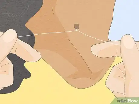 Image titled Remove a Skin Tag from Your Neck Step 3