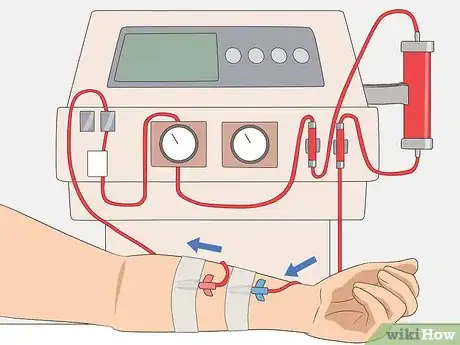 Image titled Bring Down High Creatinine Levels Step 22