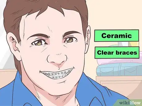 Image titled Hide Braces Step 1