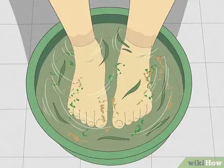 Image titled Make Your Feet Smell Good Step 6