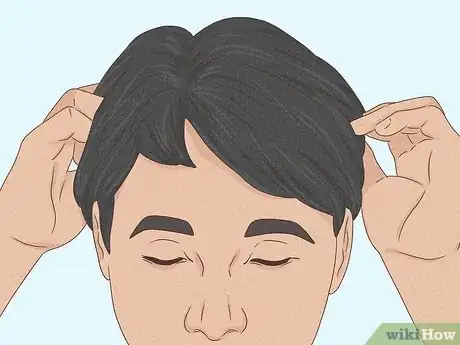 Image titled Know if You Have Male Pattern Baldness Step 7