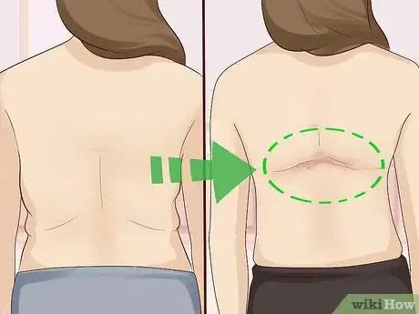 Image titled Get Rid of Bra Bulge or Bra Fat Step 11.jpeg