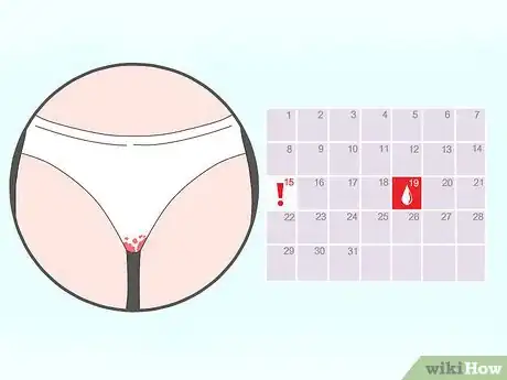 Image titled Recognize Implantation Bleeding Step 1