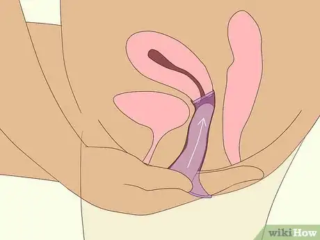 Image titled Use a Female Condom Step 10