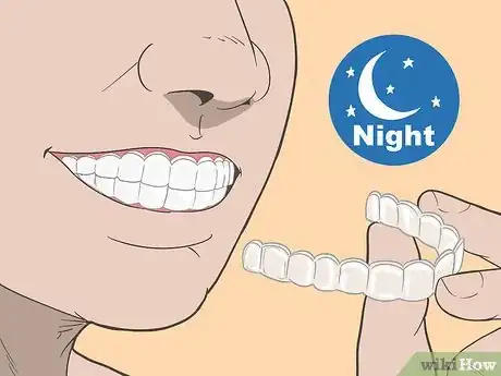 Image titled Put Invisalign Back in if You Haven't Worn Them for a Long Time Step 3