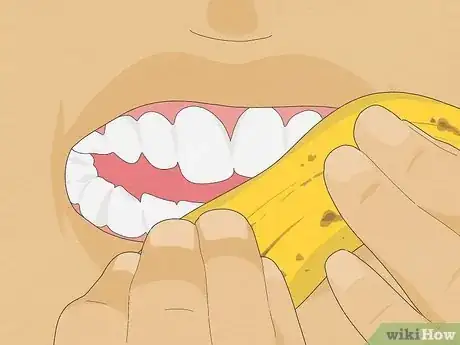 Image titled Whiten Your Teeth with Banana Peel Step 4