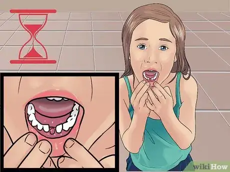 Image titled Stop the Bleeding After You Pull out a Loose Tooth Step 1