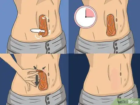 Image titled Remove Stomach Hair Step 3