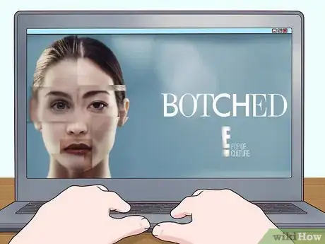 Image titled Get Cast for the TV Show Botched Step 6