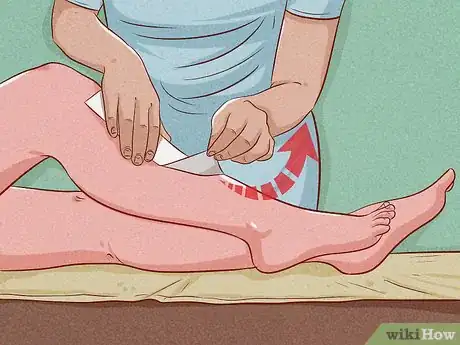 Image titled Get Rid of Unwanted Hair Step 18