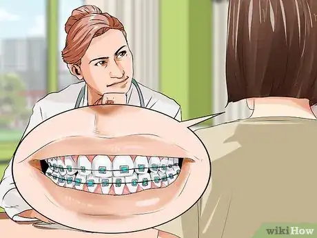 Image titled Connect a Rubber Band to Your Braces Step 1