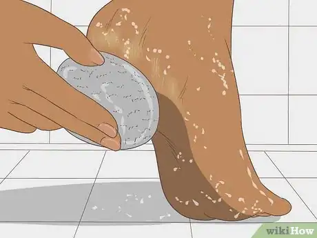 Image titled Remove Dry Skin from Your Feet Using Epsom Salt Step 15