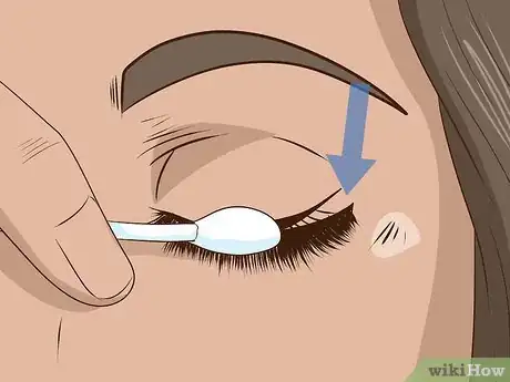 Image titled Remove Eyelash Extensions Step 15