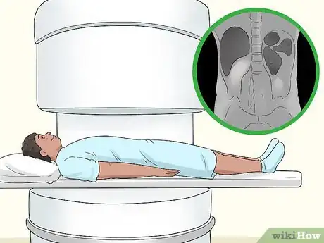 Image titled Distinguish Between Kidney Pain and Back Pain Step 10