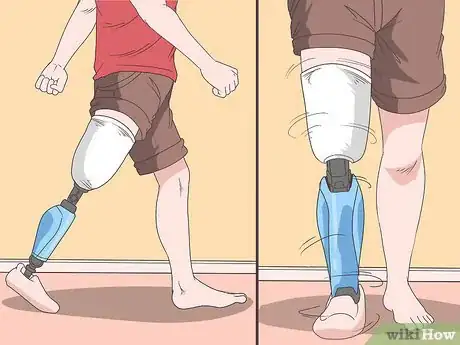 Image titled Wear a Prosthesis Step 8