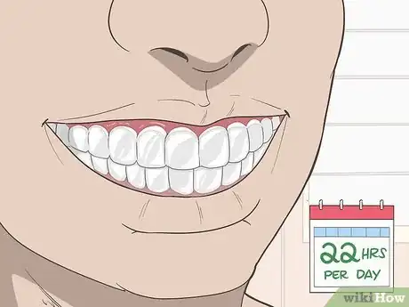 Image titled Put Invisalign Back in if You Haven't Worn Them for a Long Time Step 8