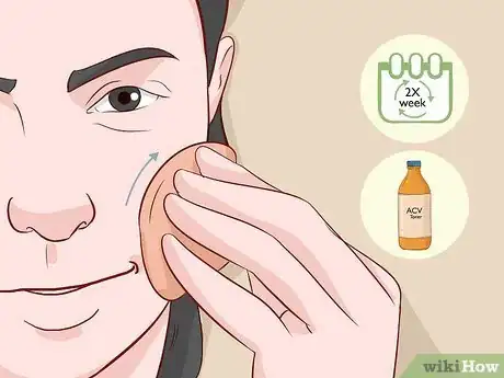 Image titled Wash Your Face with Apple Cider Vinegar Step 9
