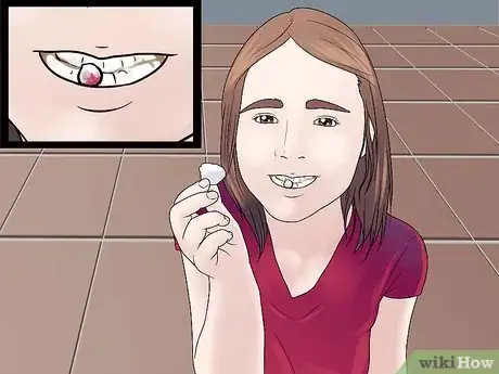 Image titled Stop the Bleeding After You Pull out a Loose Tooth Step 9