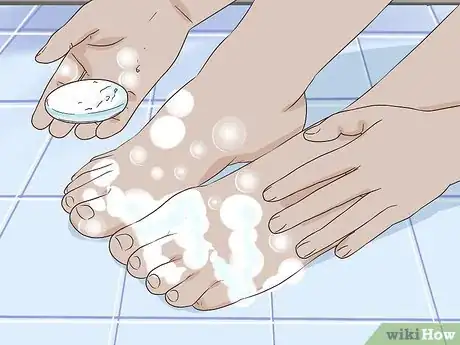 Image titled Remove Stains from Your Feet Step 2