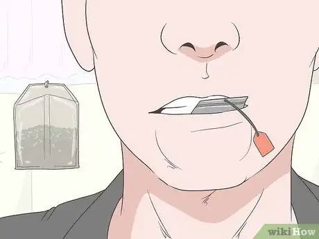 Image titled Treat Cold Sores Inside Your Mouth Step 4