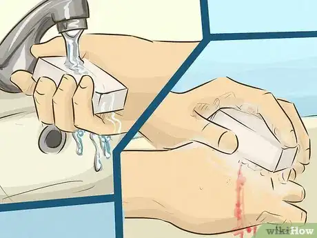 Image titled Stop Bleeding Step 12