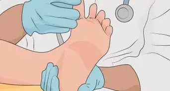 Treat a Cut Between Your Toes