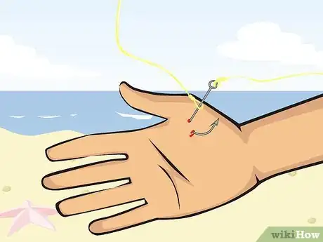 Image titled Pull a Fish Hook from Your Finger Step 11