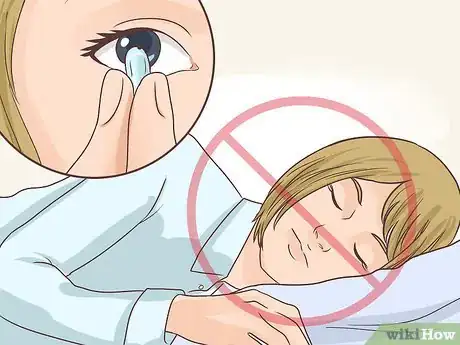 Image titled Remove a Broken Contact Lens Step 12