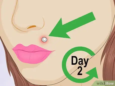 Image titled Tell if a Piercing Is Infected Step 1