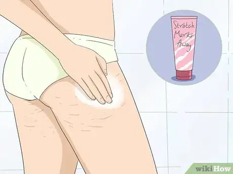 Image titled Get Rid of Stretch Marks at Home Step 1