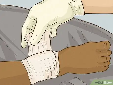 Image titled Stop Bleeding Step 20