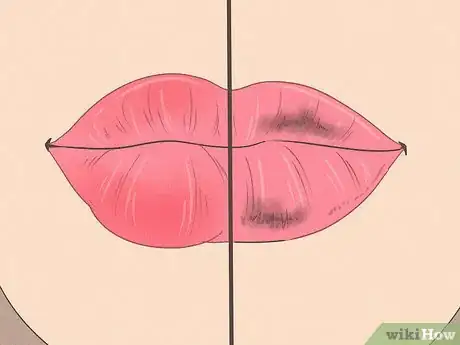 Image titled Make Your Lips Bigger Step 37